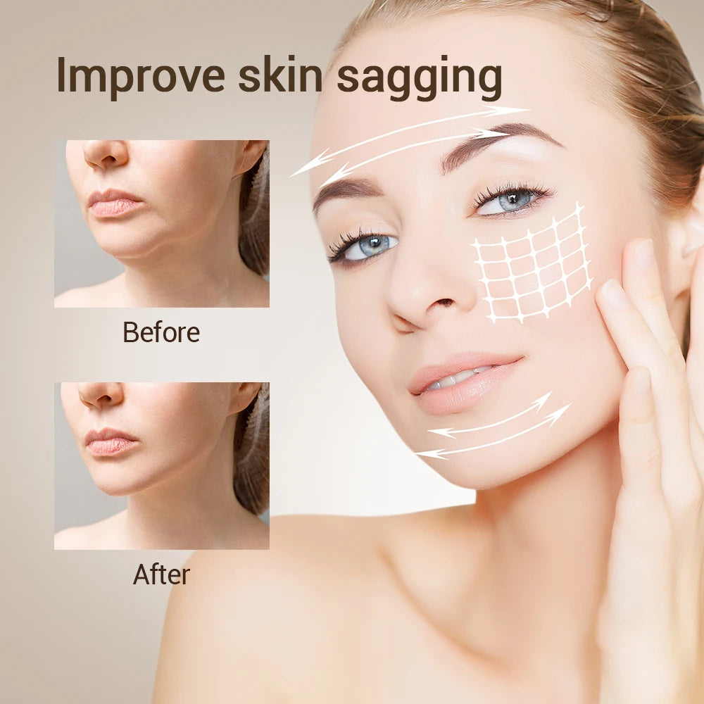2Pcs Firming Face-lift Slimming Cream V-Shape Slimming Removal Masseter Muscle Double Chin Face Fat Burning Anti-Wrinkle Product
