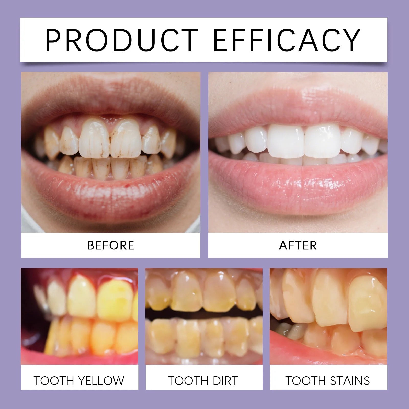 Bee Venom Toothpaste Teeth Brightening Gum Restoration Enamel Protection Sensitive Teeth Improve Plaque Stains Fresh Breath