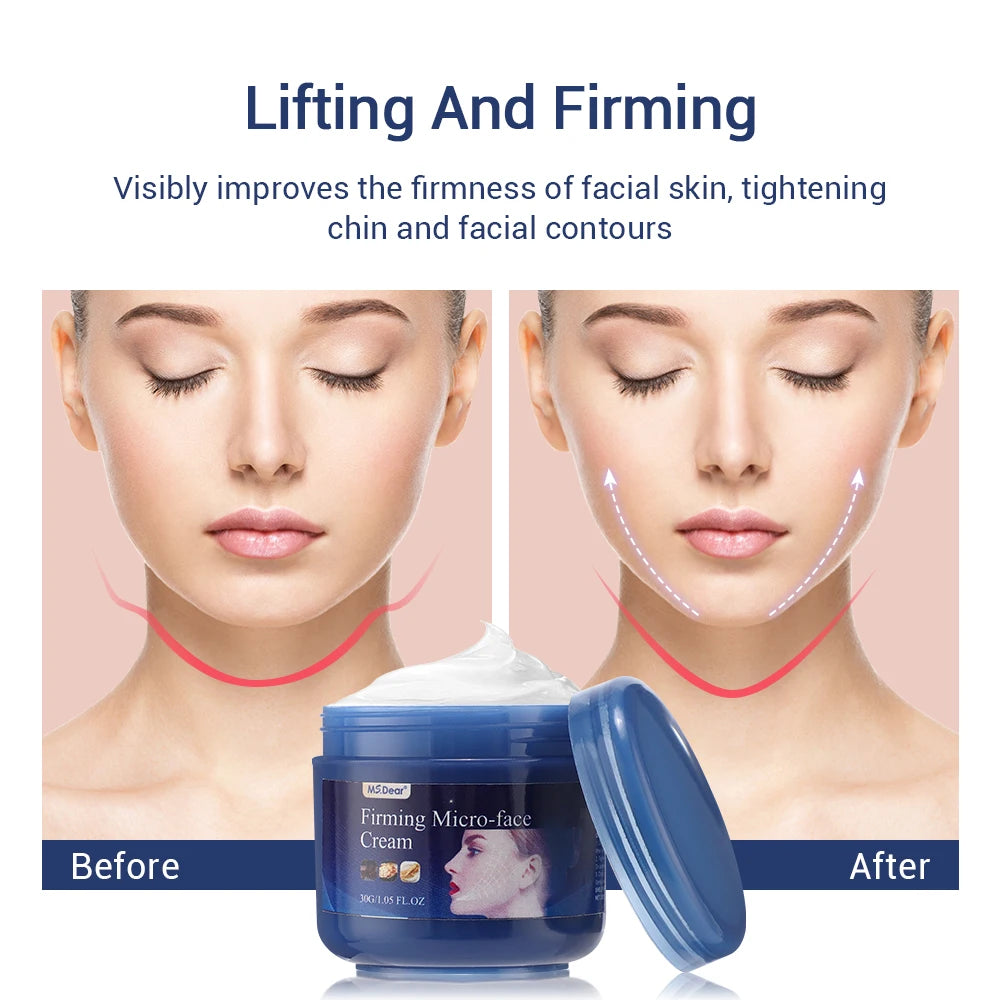2Pcs Firming Face-lift Slimming Cream V-Shape Slimming Removal Masseter Muscle Double Chin Face Fat Burning Anti-Wrinkle Product