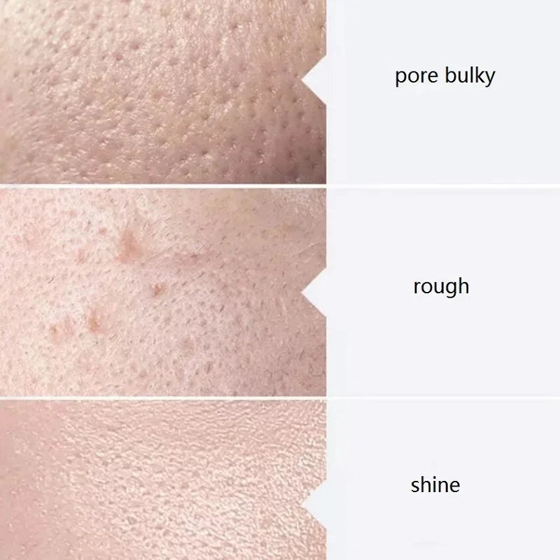 Facial Skincare Face Serum AS1 SA2 AO3 Aqua Peel Solution For Facial  Skin Deep Cleaning 400ml Kit of 3 Serums