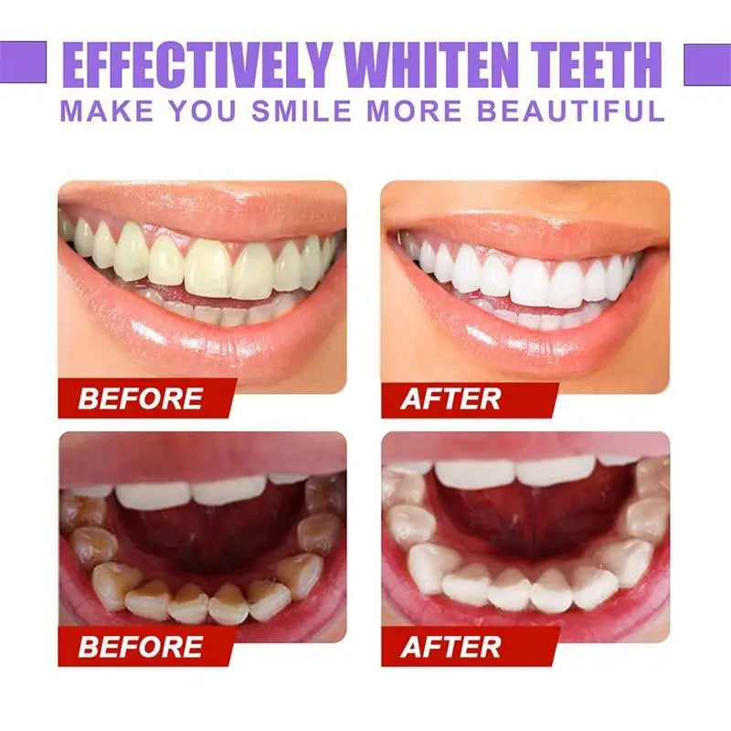 Whitning Toothpaste Freshen Breath Remove Stains Oral Hygiene Clean