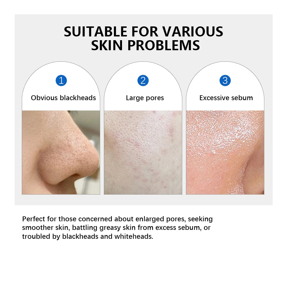 Dual-Textured Facial Toner Pads for Exfoliation and Pore Care