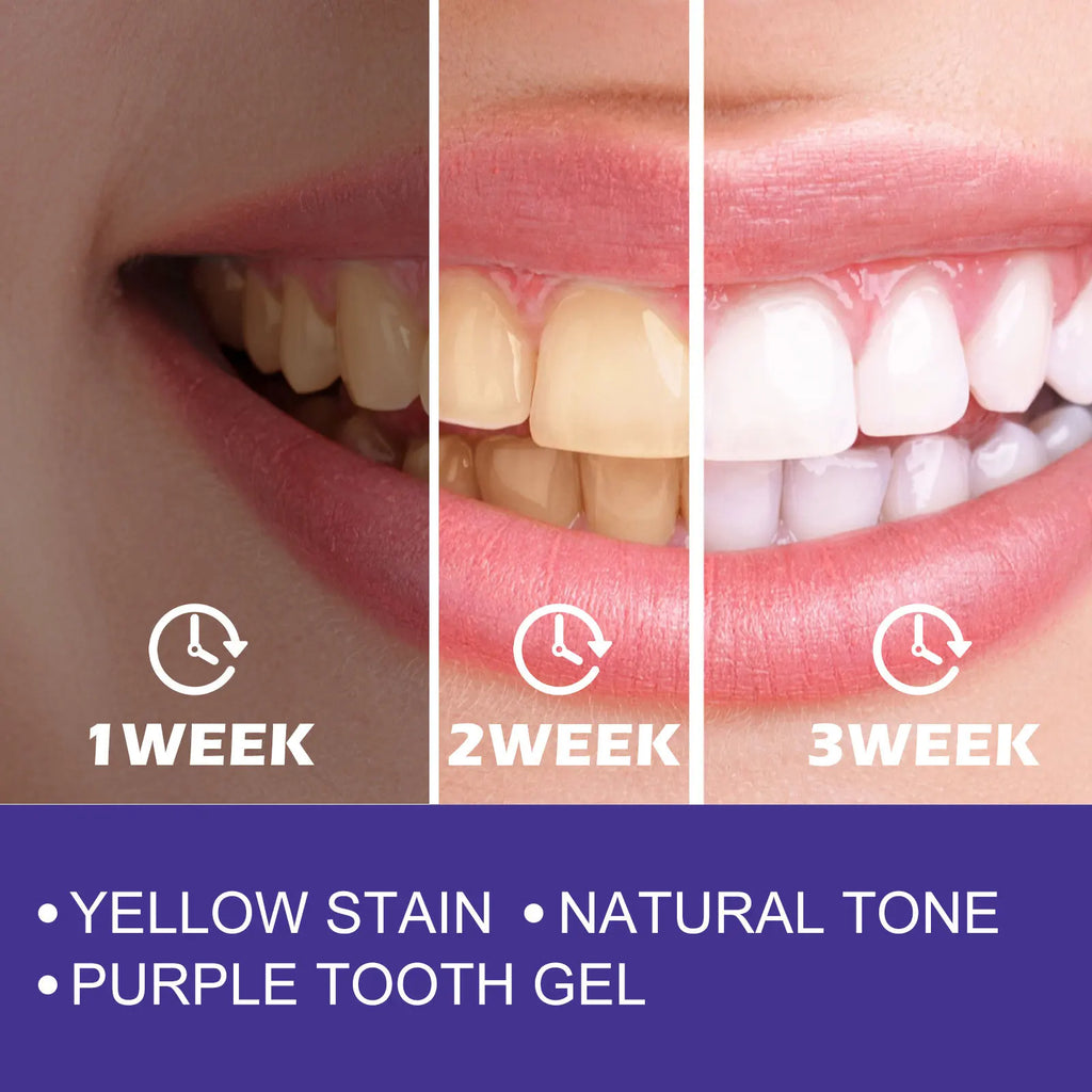 Purple Toothpaste Teeth Whitening Remove Yellow Stains Fights Tartar Fresh Breath Oral Hygiene Teeth Care Cleaning Toothpaste
