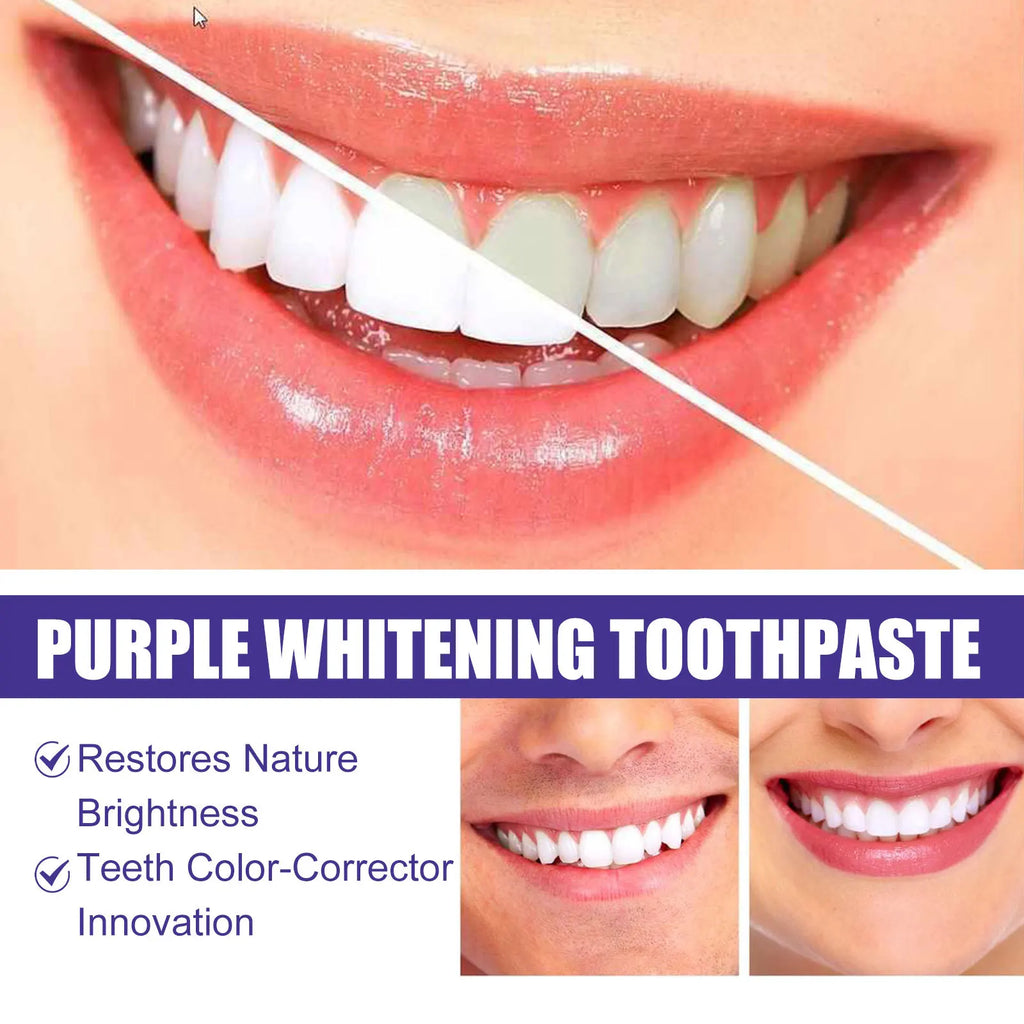 Purple Toothpaste Teeth Whitening Remove Yellow Stains Fights Tartar Fresh Breath Oral Hygiene Teeth Care Cleaning Toothpaste